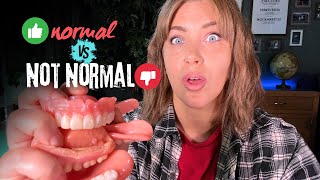 Dentures Whats Normal vs Not Normal [upl. by Anomer]