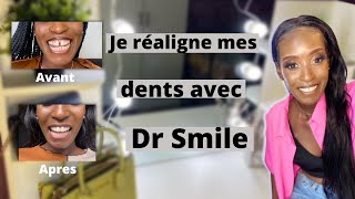 TRAITEMENT DR SMILE Dents du bonheur resserrer en 5mois gouttières invisibles prix douleurs [upl. by Ritz689]