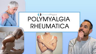 Polymyalgia Rheumatica  Signs and Symptoms of PMR [upl. by Eihpos134]