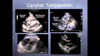 Tutorial Basic echocardiography [upl. by Cherianne772]