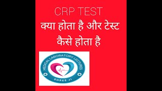 CRP TEST AND ITS PRINCIPLE HOW TO PERFORM THIS TEST HINDI amp ENGLISH [upl. by Adnauqaj485]