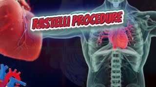 Rastelli procedure  Human Heart and Cardiology ❤️❤️❤️🔊✅ [upl. by Dnalloh]