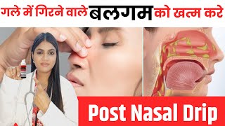 PostNasal Drip Homeopathic Treatment  गले में बलगम का गिरना  Causes Symptoms amp Medicines [upl. by Noemys]