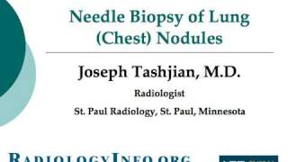 Your Radiologist Explains Needle Biopsy of Lung Chest Nodules [upl. by Atkinson]