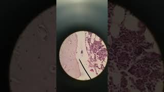 Bone decalcified histology [upl. by Marilyn]