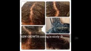 My Natural Hair Journey TEXTURIZER to NATURAL [upl. by Ern]