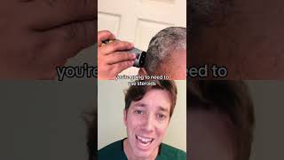 How to Get Rid of Dandruff  Seborrheic Dermatitis [upl. by Pammie]