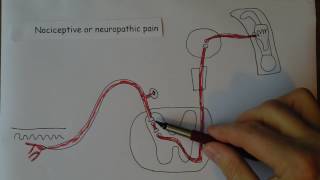 Neuropathic pain [upl. by Dhu572]