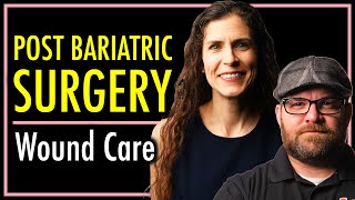 Wound Care After Bariatric Surgery  theSITREP [upl. by Nylg]