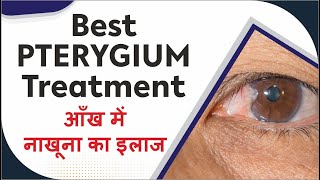 Best Pterygium treatment  Pterygium Surgery  आँख में नाखूना का सही इलाज  Nakhuna ka sahih ilaj [upl. by Annaiek]