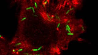 The Shigella flexneri actin tail in untreated conditions [upl. by Xavier]