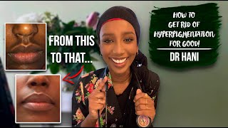 How To Get Rid Of Hyperpigmentation  Dr Hani [upl. by Sheaff]