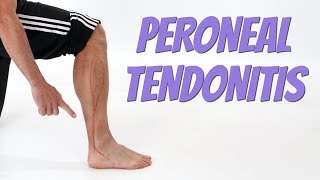 Peroneal Tendonitis Side of Foot Pain Causes amp SelfTreatment [upl. by Llenoj]