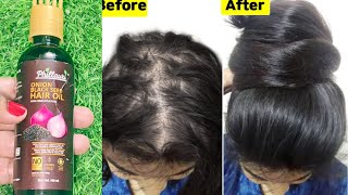 Onion Black seed hair oil review  Onion Black Seed hair Oil benefits  Onion black seed hair oil [upl. by Ahsienek]