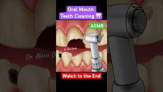 ASMR Mouth 👄 Teeth 🦷 [upl. by Danita992]