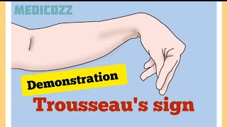 Trousseaus sign in Hypocalcemia  Patient video  causes treatment prevention [upl. by Dudley581]