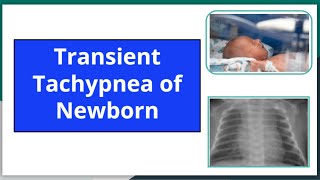 Transient tachypnea of newborn mbbs newbornneonatology neetpg pediatrics nursing ttn [upl. by Dibri489]