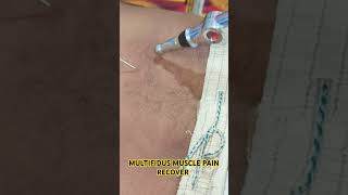 HOW TO RECOVER MULTIFIDUS MUSCLE PAINshort viralshorts live facts [upl. by Prasad]