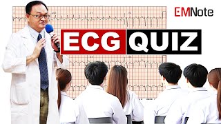 ECG Quiz for ACLS and Clinical Practice [upl. by Kavita46]