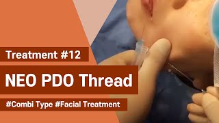 NeoGenesis Thread Series PDO Combi Type Facial Treatment [upl. by Matland]