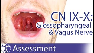 Cranial Nerve 9 amp 10 Examination  Glossopharyngeal amp Vagus Nerve Assessment for Physiotherapists [upl. by Schilt]