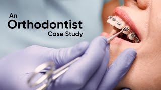 An Orthodontist Case Study [upl. by Merideth]