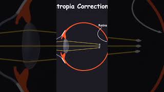 optics  hypermetropia and corrections physics scienceshorts scienceclass10 shortviral [upl. by Suicul]