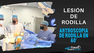 Artroscopia de Rodilla en 60 segundos [upl. by Ettigirb]