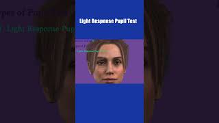 Pupil Examination  RAPD  Pupillary Light Reflex  Marcus Gunn Pupil  Swinging flashlight Test [upl. by Enala]