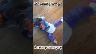 Our Hip Dysplasia Journey  Hip Spica Cast  Crawling [upl. by Novaj]