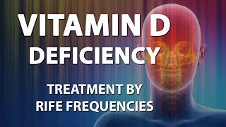 Vitamin D Deficiency  RIFE Frequencies Treatment  Energy amp Quantum Medicine with Bioresonance [upl. by Abey]