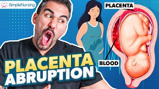 Placental Abruption Symptoms Causes Nursing Interventions  NCLEX Tips [upl. by Chao35]