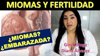 MIOMAS FERTILIDAD Y EMBARAZO POR GINECÓLOGA DIANA ALVAREZ [upl. by Enaht841]