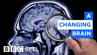 How pregnancy dramatically resculpts the brain  BBC REEL [upl. by Fisher]