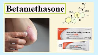 betamethasone [upl. by Hearsh]