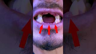 ‼️NUEVA DENTADURA‼️para que te inspires mrdent dentadura sabiasque misterdent curiosidades [upl. by Coffin942]