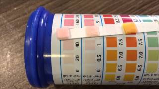 What Type Of Aquarium Water Testing Kit Should You Use Strips VS master test kit [upl. by Einnel]