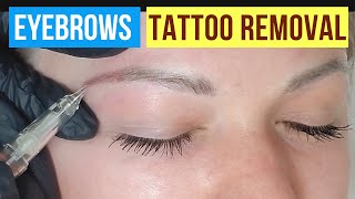 How to remove PMU eyebrows Eyebrow Tattoo Removal full procedure [upl. by Helprin]