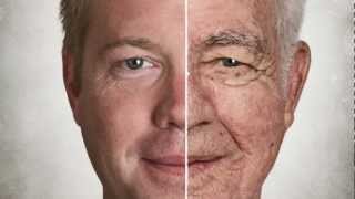 Skin Aging  What are the early signs of aging [upl. by Leidba]