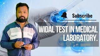 Understanding the Widal Test in Medical Laboratory A Comprehensive Guide [upl. by Eema171]