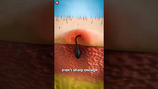 What is ingrown hair 🔥 amazingfacts knowledge hair factsinhindi [upl. by Yecart]