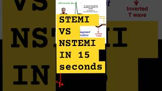 STEMI vs NSTEMiecg ST segment elevation vs ST segment depression stemi  cathlab [upl. by Deerdre]