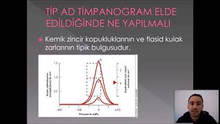 ODYOLOJİDE TİMPANOMETRİK TESTLER VE DEĞERLENDİRİLMELERİ [upl. by Nyladnek]