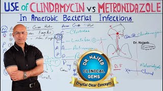 Clindamycin vs Metronidazole  Anaerobic Infection  Pharmacology💊 [upl. by Evod350]