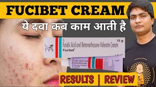 fucibet cream  fucibet cream uses in hindi  fucibet cream uses [upl. by Nahsaj]