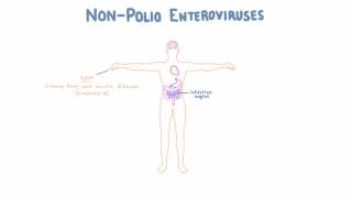 Non Polio Enteroviruses  Echovirus Coxsackievirus and Enterovirus [upl. by Pittel]