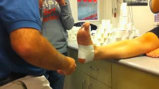 Acute Calcaneal Periostitis  Basket Weave Taping Technique [upl. by Ttenyl201]