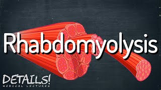 Rhabdomyolysis  Details [upl. by Philemon134]