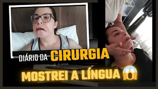 Estou bem dolorida inchada fiz drenagem [upl. by Wu461]