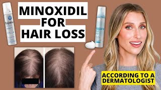 Dermatologist Explains How Minoxidil Works for Hair Loss How to Use Results amp More [upl. by Fabiola]